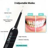 Ultrasonic Teeth Cleaner Dental Tartar Remover Teeth Whitening Scaler Electric Toothbrush Dental Calculus Remover Oral Irrigator